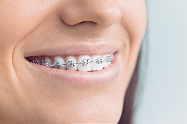Best Invisalign and Clear Aligners  in Talent, OR
